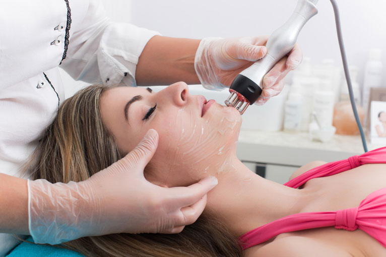 laser therapy for acne