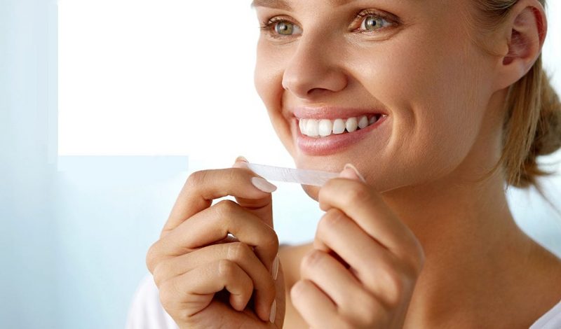 Miếng dán trắng răng là gì: Nên dùng loại nào tốt nhất & Cách sử dụng đúng