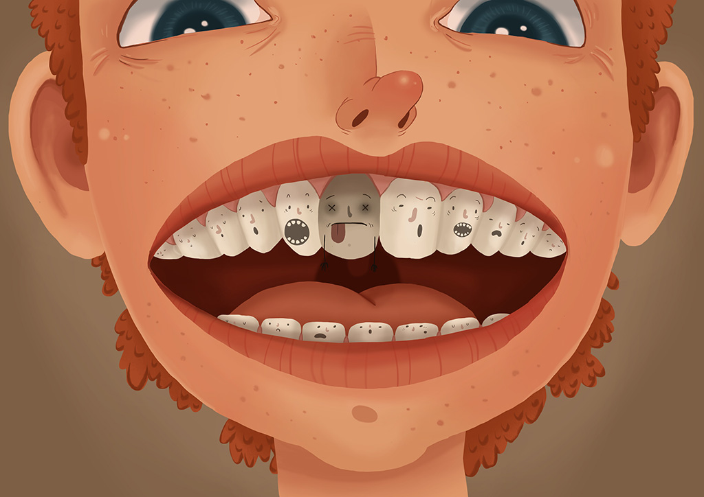 tẩy trắng răng có hại không?