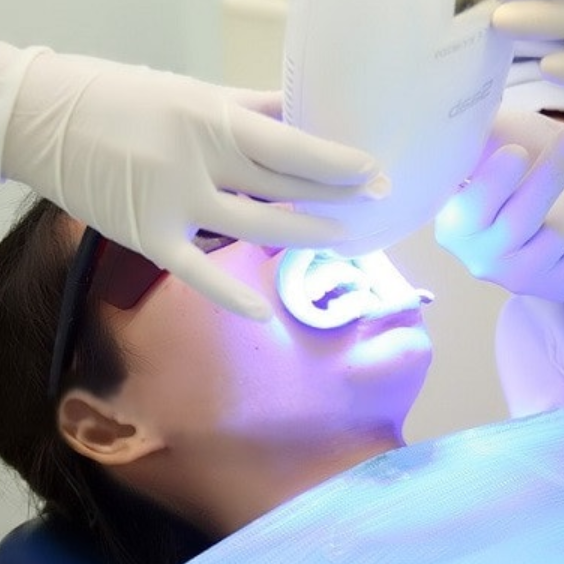 Phương pháp tẩy trắng răng nha khoa bao nhiêu tiền?