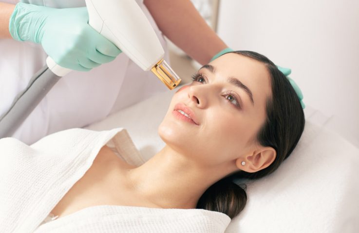 Liệu pháp laser có thể điều trị đốm nâu trên da 