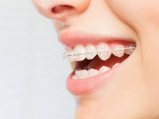 Liệu pháp vệ sinh răng miệng hiệu quả