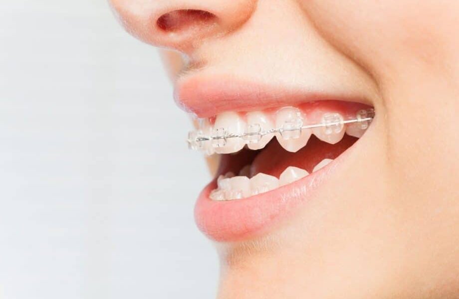 Liệu pháp vệ sinh răng miệng hiệu quả