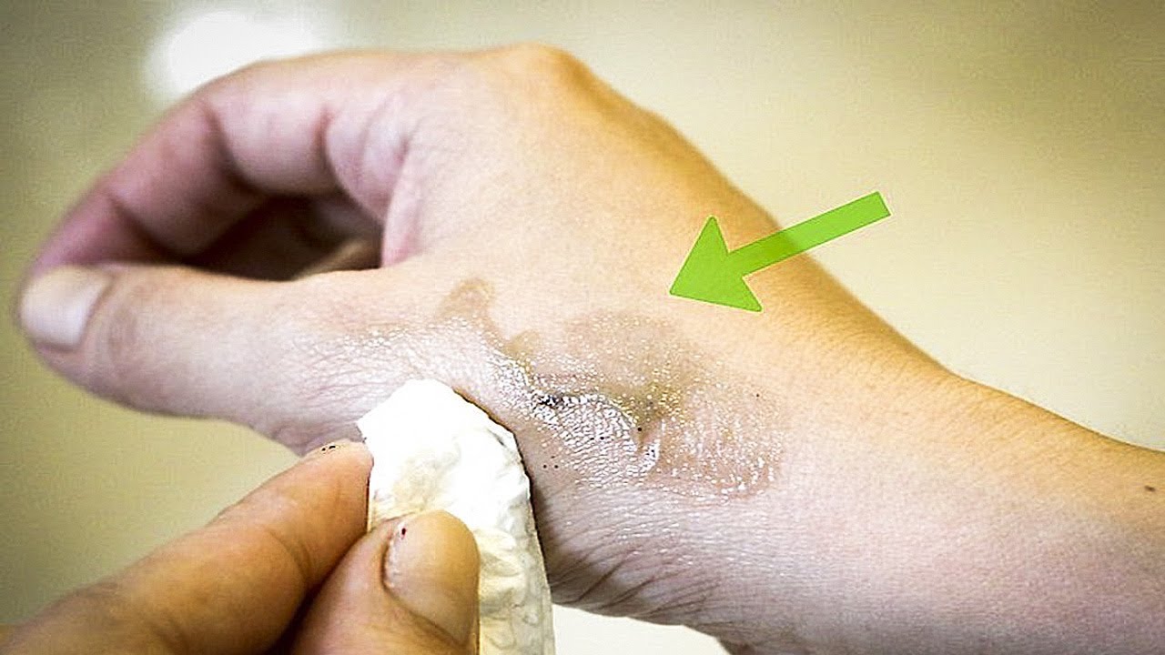 Cách tẩy hết thuốc nhuộm dính trên da bằng chính thuốc nhuộm