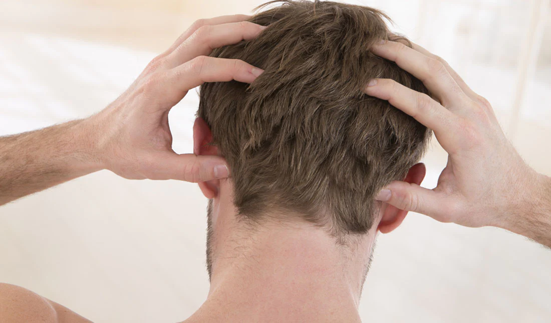 tại sao da đầu nam giới thường xuyên bị ngứa