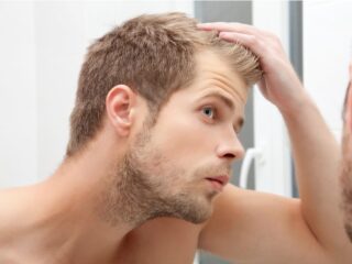 nguyên nhân gây rụng tóc ở nam giới